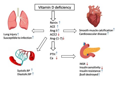 Vitamin D Covid